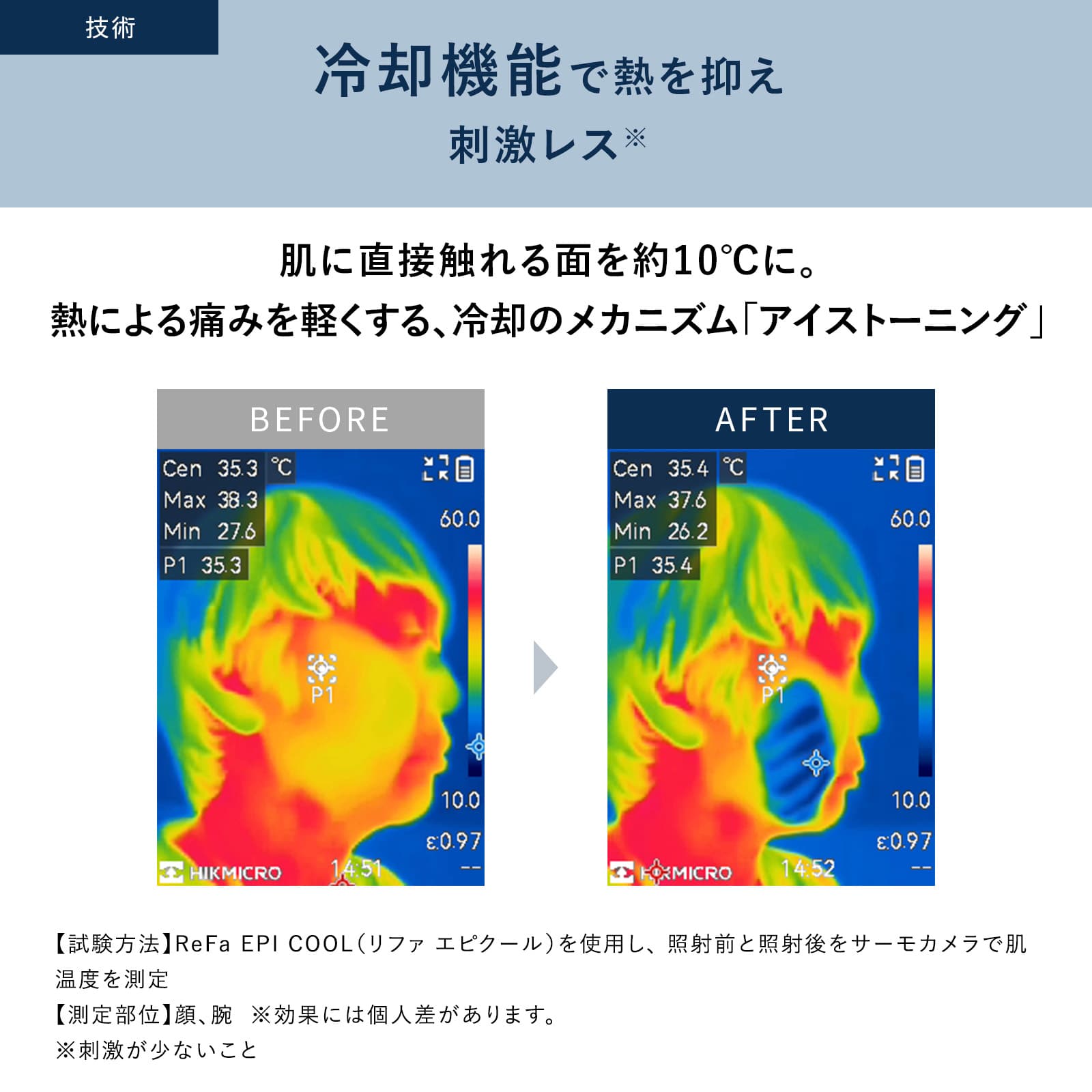 リファエピ クール 光美容器 VIO ヒゲ 顔 脇 ワキ メンズ: MTG