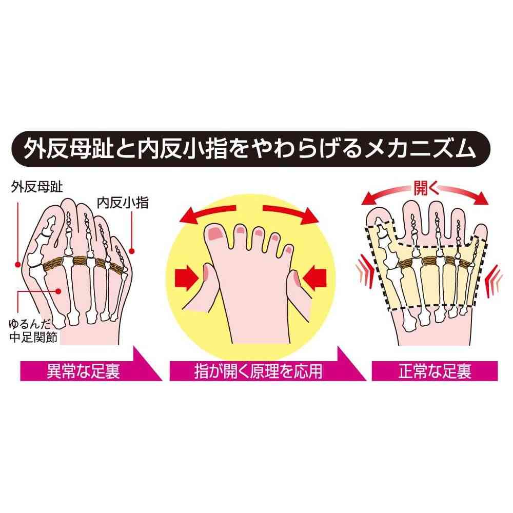 アルファックス 外反母趾・内反小指サポーター S左足用