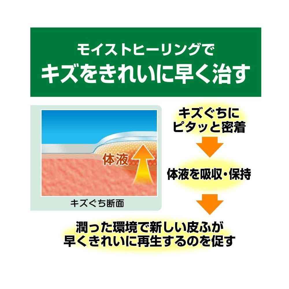 【管理医療機器】ニチバン ケアリーヴ治す力 CN12M M-12枚