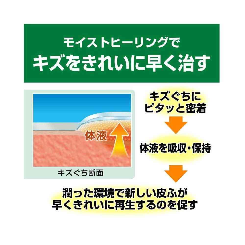 【管理医療機器】ニチバン ケアリーヴ治す力 CN9L L‐9枚