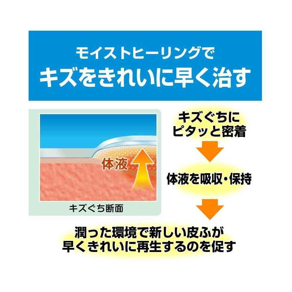 【管理医療機器】ニチバン ケアリーヴ 治す力 防水タイプ CNB5B ビッグサイズ 5枚
