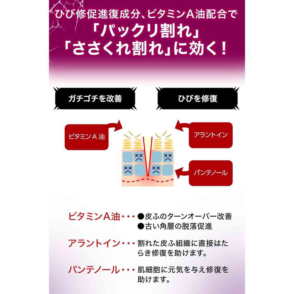 【第3類医薬品】ヒビケアFT軟膏 20g