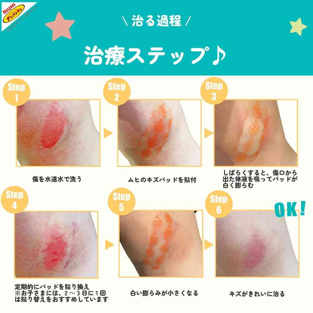 【管理医療機器】ムヒのキズパッド 10枚