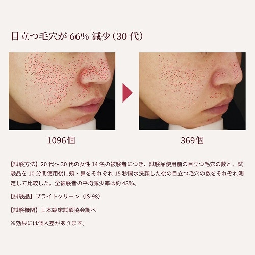 ブライトクリーン